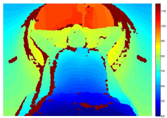 Figure 1 Depth map from a test person, acquired by the Microsoft Kinect. The colormap show the Kinect raw values. The test person is located in front of the CT on the CT couch. Areas coloured in dark red indicate that the Kinect does not receive any dot patterns; for these areas, no depth information is available.