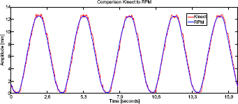 Figure 3 Comparison of Kinect and RPM signals for a sinusoidal motion phantom movement of 12 millimeter amplitude. The two signals are very well aligned.