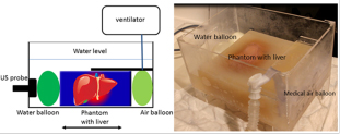 Figure 1 Ex-vivo ovine liver embedded into an agar phantom, showing (a) a schematic drawing and (b) a photograph of the arrangement, green balloons are sequentially filled and emptied to induce breathing like motion of the liver.