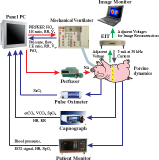 Figure 1 System configuration for the automatic control of ventilation with induced ARDS [8].