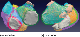 Figure 4 Annotated fiber orientation in a volumetric structured hexahedral model including interatrial bridges. Colors correspond to paths in Figures 2 and 3.