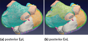 Figure 5 Annotated fiber orientation in a trianguler surface mesh including interatrial bridges. Colors correspond to paths in Figures 2 and 3.