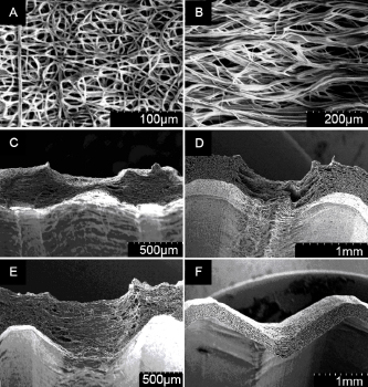 Figure 4 SEM images of representative samples show homgeneous fiber deposition on the tooth head (A) whereas fibers between two tooths were mainly deposited via gap-spinning. Furthermore, the cross-sectional view of the grafts demonstrates an increasing fiber penetration to the tooth root with increasing flank angle: (C) 30° v-thread, (D) round thread, (E) 90° v-thread.