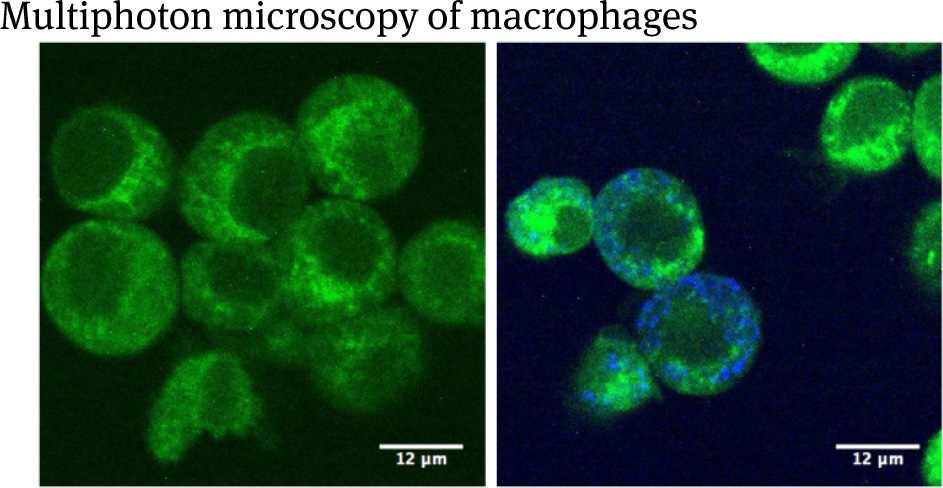 Figure 3 Left side: SPIO nadve macrophages; right side: macrophages incubated with Resovist-Fe. Bar = 12 μm. Cells are detected with by signal within the spectral range of 435– 495 nm in epi-direction with an excitation at 740 nm (depicted in green). Intra cellular SPIOs are shown by a signal with a detector for <435 nm, excited at 1200 nm (depicted in blue).