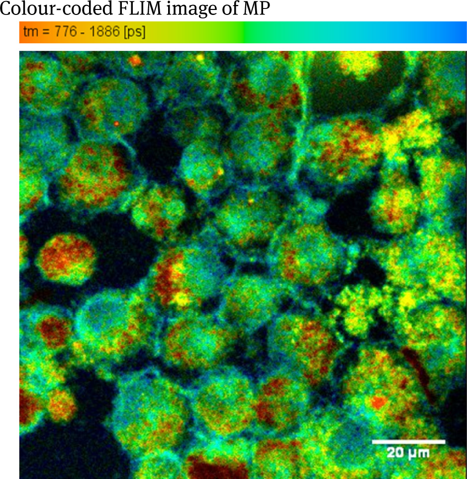 Figure 4 Colour-coded FLIM image of MP loaded with Resovist-Fe, excited at 760 nm