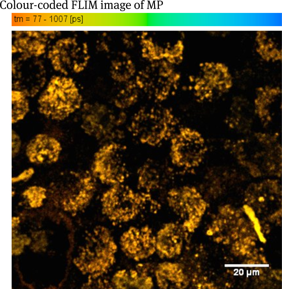 Figure 5 Colour-coded FLIM image MP loaded with Resovist, excited at 1200 nm.