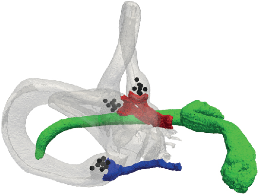 Figure 1: Meshed vestibular system with the facial nerve (green), the posterior ampullary nerve (blue) and the adjoined anterior and lateral ampullary nerves (red). In the ampullae of the semicircular canals, several electrode configurations (black) are embedded.