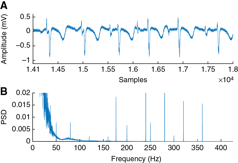 Figure 1 Unipolar EGM which is overlain with noise, recorded with ORION (A). A cutout of the corresponding PSD is illustrated in (B). Several artificial discrete peaks are visible.