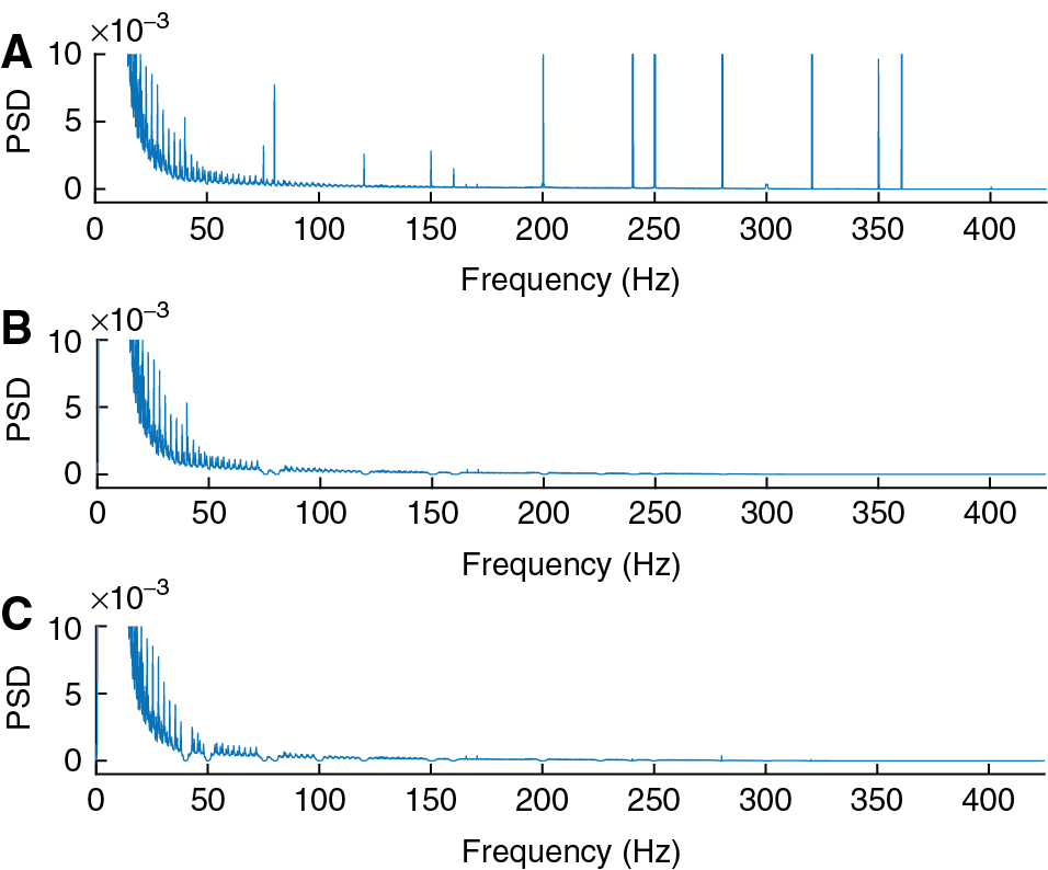 Figure 2 The PSD before filtering (A), after filtering using the peak detection algorithm (B) and after filtering using the f0 calculation (C).