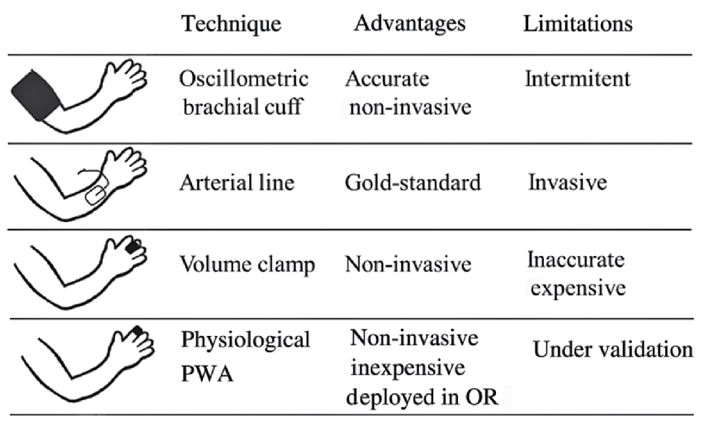 Figure 1 Summary of available blood pressure (BP) monitoring technologies in the operating room.