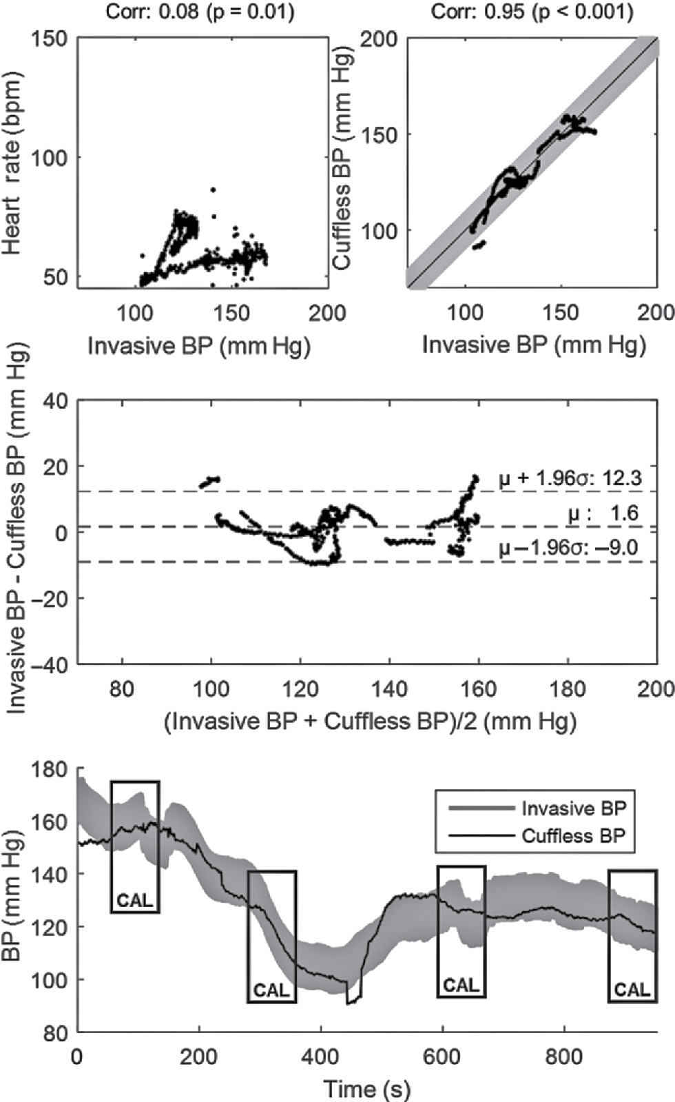 Figure 3 Performance of the cuffless blood pressure estimation technique on a particular study patient during induction of anesthesia. Each data point corresponds a patient’s heart beat. Temporal evolution of invasive systolic blood pressure is displayed as ±8 mm Hg range (shaded in grey).