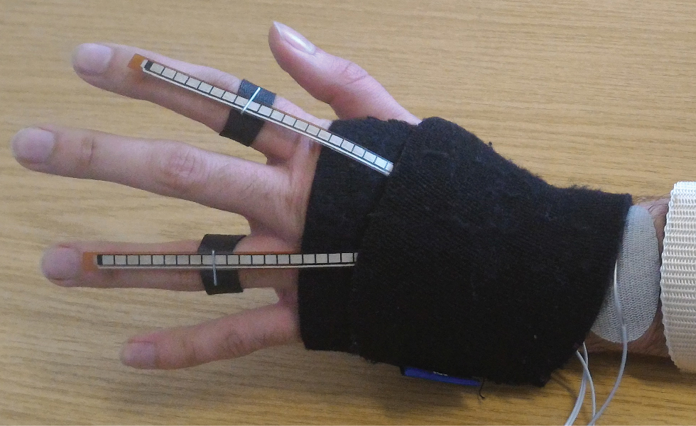 Figure 3 flex sensors with wristband and attachment rings for hand movement characterization of a stroke patient.