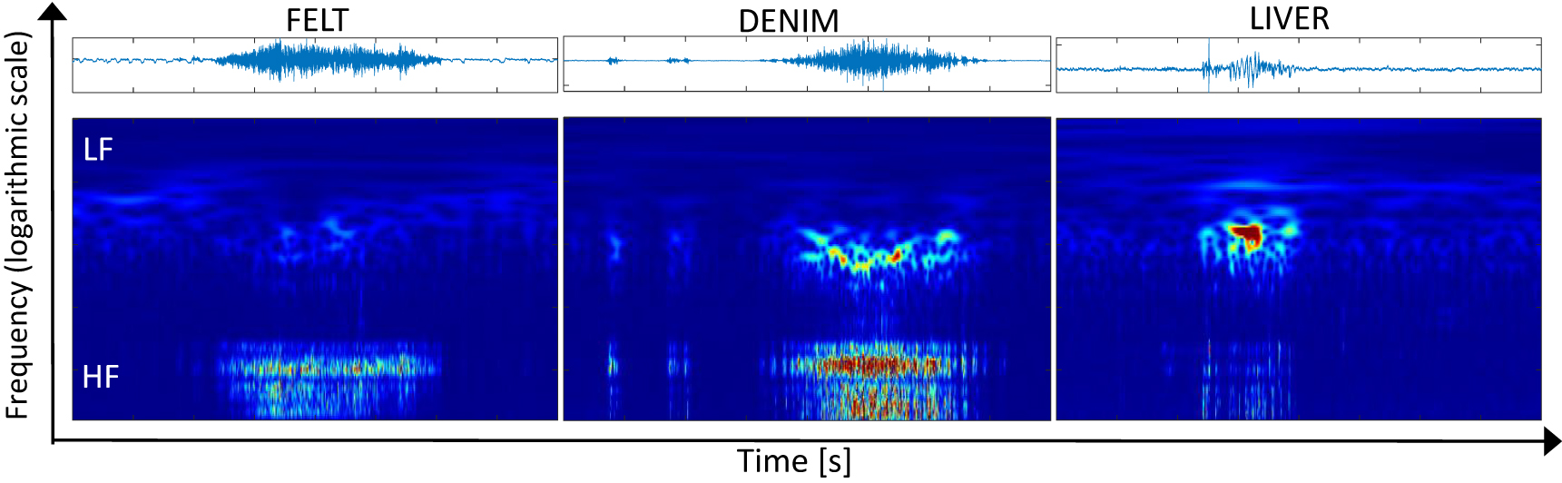 Figure 3: Time-domain and time-scale representations of the audio signal resulting from the interaction of the robotic tool with three different tissues.