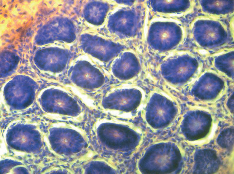 Figure 6a Normal group.