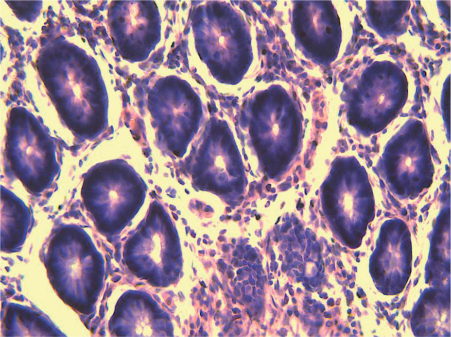 Figure 6d Moderate dose group.