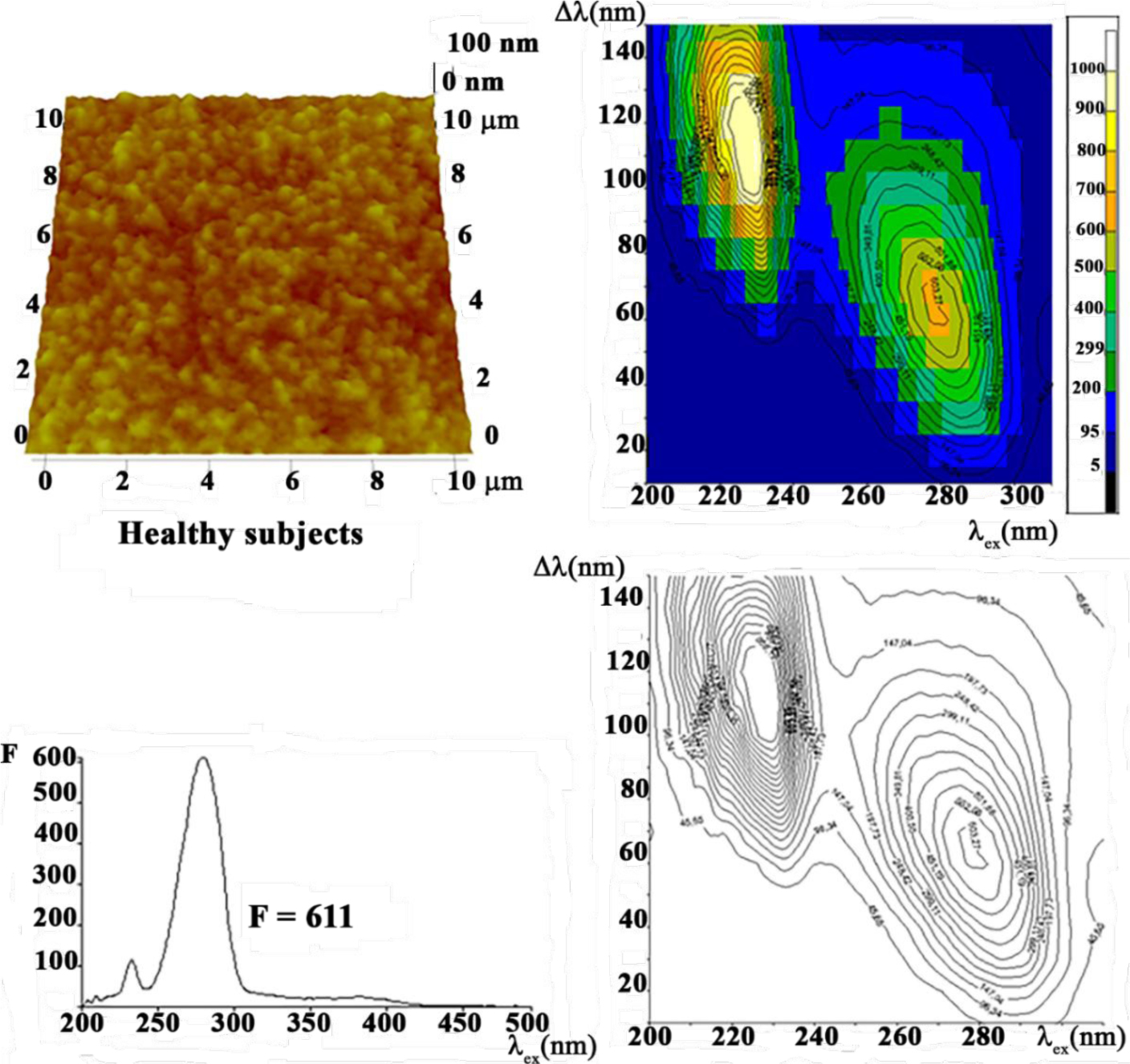 Figure 1 Blood serum of healthy subjects studied by synchronous fluorescence fingerprint and atomic force microscopy.