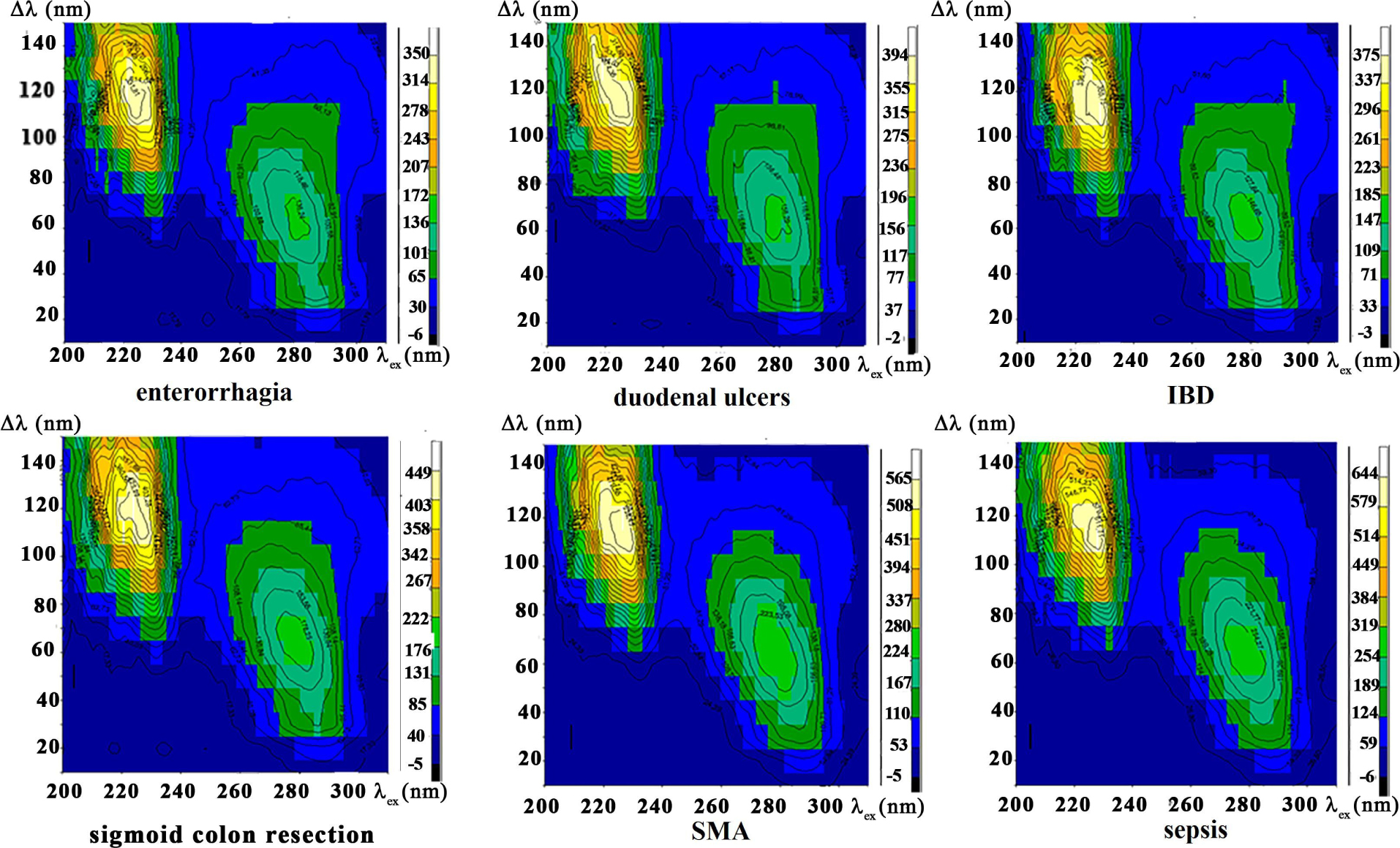 Figure 4 Synchronous fluorescence fingerprints in colours show more detailed intensity of autofluorescence of blood serum of selected ischemic patients suffering from enterorrhagia, inflammatory bowel disease (IBD), duodenal ulcers, sigmoid colon resection, superior mesenteric artery (SMA) thrombosis and sepsis.