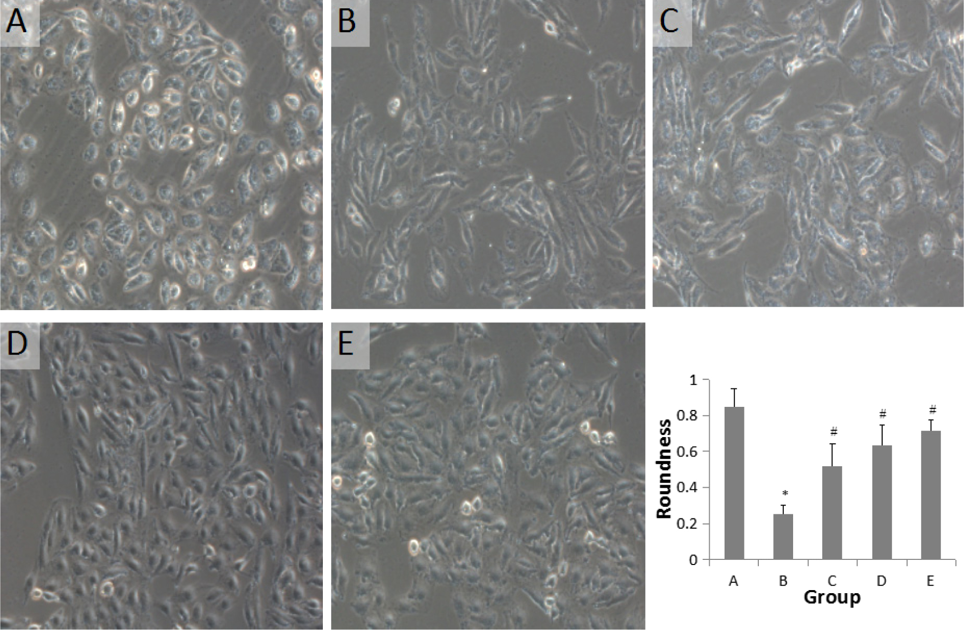 Figure 1 Changes in the morphology and roundness values of A549 cells stimulated by different concentrations of GLXB-D drug serum and TGF-β1 for 24h (×200). (A): control group; (B): 5ng/mL TGF-β1 induced group; (C): 5% GLXB-D drug serum group; (D): 10% GLXB-D drug serum group; (E): 15% GLXB-D drug serum group. Comparison with control group: *P<0.05; comparison with the TGF-β1 induced group: #P<0.05.