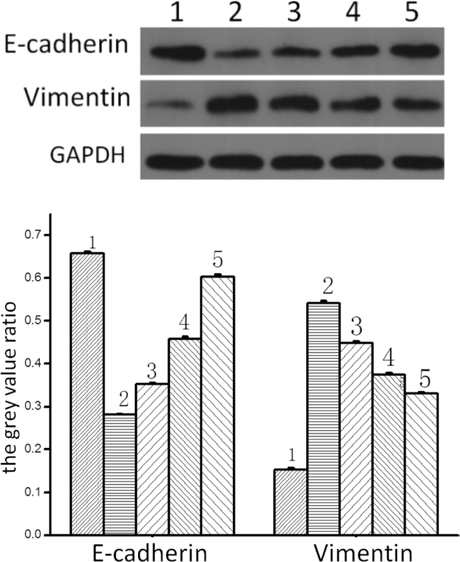 Figure 2 Western blot results showing the expression levels of A549 cells treated with different concentrations of GLXB-D drug serum and TGF-β1 for 24 h . (A): The protein expression straps of E-cadherin and Vimentin; (B): The grey value ratio of expressions of E-cadherin and Vimentin. (1) control group; (2) 5ng/mL TGF-β1 induced group; (3) 5% GLXB-D drug serum group; (4) 10% GLXB-D drug serum group; (5) 15% GLXB-D drug serum group.