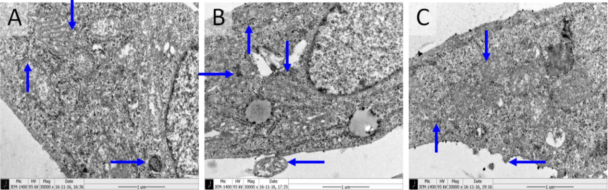 Figure 3 Representative transmission electron microscopic pictures of the ultrastructure of cells (Lead and uranium double staining, ×30000). A: control group; B: 5ng/mL TGF-β1 induced group; C: 15% GLXB-D drug serum group. Lamellar bodies (→), Microvilli (←), Mitochondria (↓), Rough endoplasmic reticulum (↑).