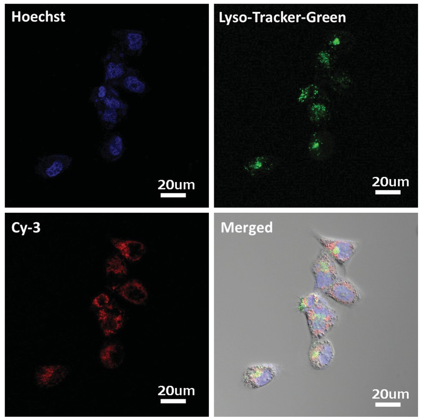 Figure 6 High magnification (×400) laser confocal microscopic images of PC-3 cells incubated with PEG-PEI/miR-scr polyplexes (N/P=20). Dose of miR-scr: 100nM. Blue: nuclei stained with Hoechst; red: miR-scr labeled with Cy3; green: lysosomes labeled with Lyso-Tracker green.a: Figure of nuclei stained with Hoechstb: Figure of lysosomes labeled with Lyso-Tracker greenc: Figure of miR-scr labeled with Cy3d: Figure of merging the three fluorescent images