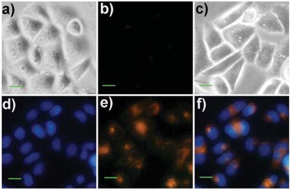 Figure 8 Bright-field and fluorescence images of HeLa cells. (a) Brightfield image of the cells treated with sensor Rh6G-1 (10 μM) for 30 min; (b) Fluorescence image of panel (a) from the red channel; (c) Bright-field image of the cells pre-treated with sensor Rh6G-1 (10 μM) and Hoechst 33258 (4.5 μM) for 30 min, and then incubated with Fe3+ (10 equiv.) for 30 min; (d) Fluorescence image of panel (c) from the blue channel; (e) Fluorescence image of panel (c) from the green/red channel; (f) Overlay of panels (d) and (e). Scale bar: 30 μm.