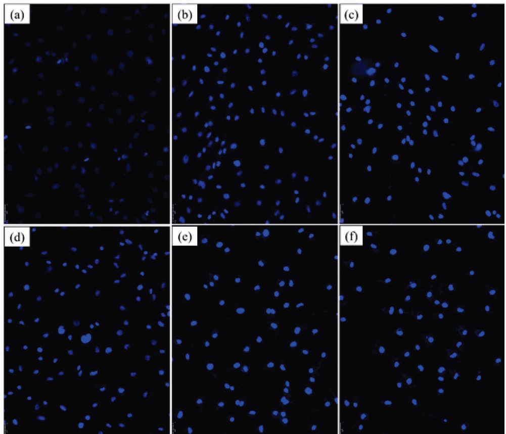Figure 2 Immunocytochemical detection of METH induced apoptosis in U-118 MG cells. Hoechst 33258 staining indicated that METH induced U-118 MG cells apoptosis. Morphologic changes in nuclei were observed with Hoechst 33258 staining under fluorescence microscopy. (a) Control group. The cells were shaped normally and had round, intact nuclei; (b) METH 198 μg/mL group; (c) METH 296 μg/mL group; (d) METH 444 μg/mL group; (e) METH 667 μg/mL group group; (f) METH 1000 μg/mL group. Original magnification is 200×.