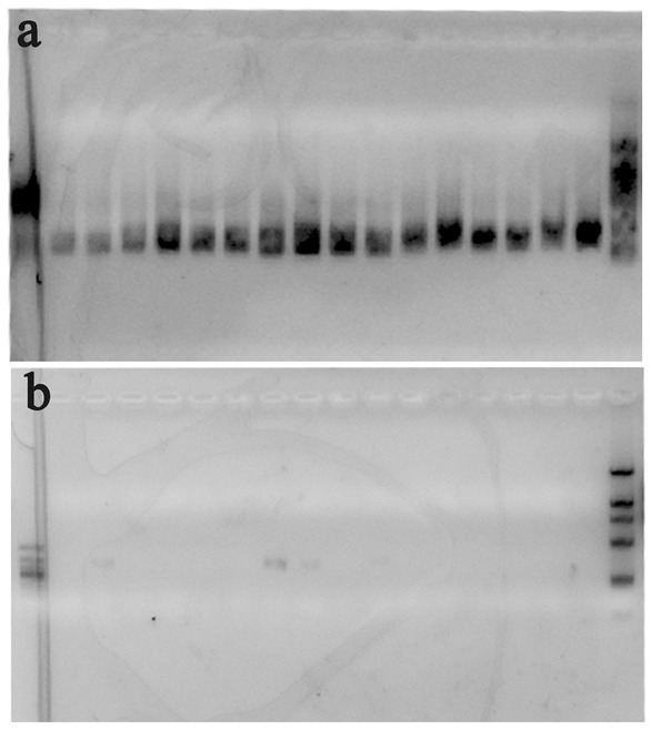 Figure 4 Agarose gel electrophoresis of PCR products based on the specific primers for bacteria (a) and fungi (b), respectively.
