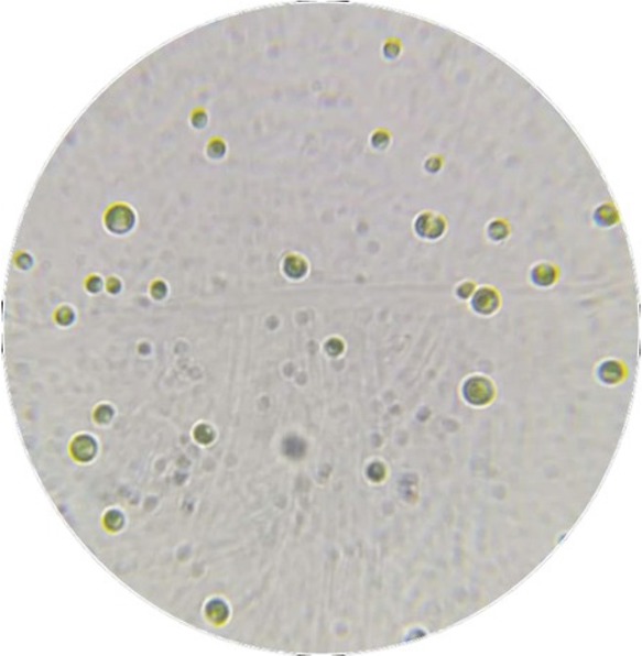 Figure 2 Microscopy picture of C. vulgaris.