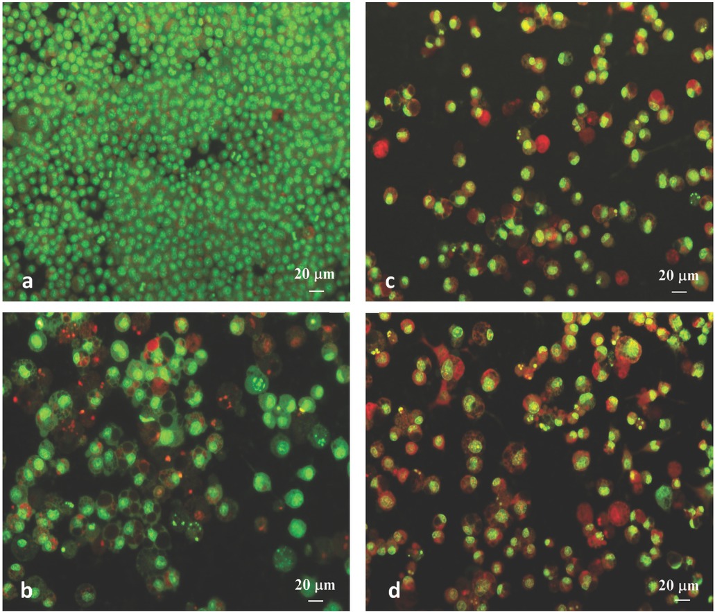 Figure 7 Rat sarcoma cell line (LSR-SF-SR) after double staining with AO/PI: a) untreated cells, b) MonH×H2O, c) complex 1; d) complex 2 (cultivation for 48 h with compounds tested at 5 μg/mL, magnification × 20).