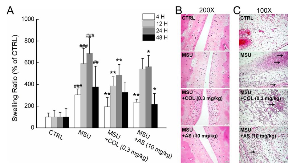 Figure 3 The anti-inflammation effects of AS on rats with acute gouty arthritis established via intraarticularly injection with 100 μg of MSU at the right ankle joint. (A) AS reduced the swelling ratio of ankle joints in rats. The percentage of swelling ratio of other groups were calculated compared with CTRL rats, which was considered to be 100%. Data are analyzed using a one-way ANOVA and expressed as mean ± S.D. (n = 12). ##P<0.01 and ###P<0.001 vs. CTRL rats. *P<0.05 and **P<0.01 vs. vehicle treated rats with acute gouty arthritis. AS prevented the inflammation of (B) ankle joints (200×) (Scale bar: 50 mm) and (C) joint capsules (100×) (Scale bar: 100 mm) detected via H&E staining. MSU, monosodium urate; COL, colchicine; AS, astilbin.