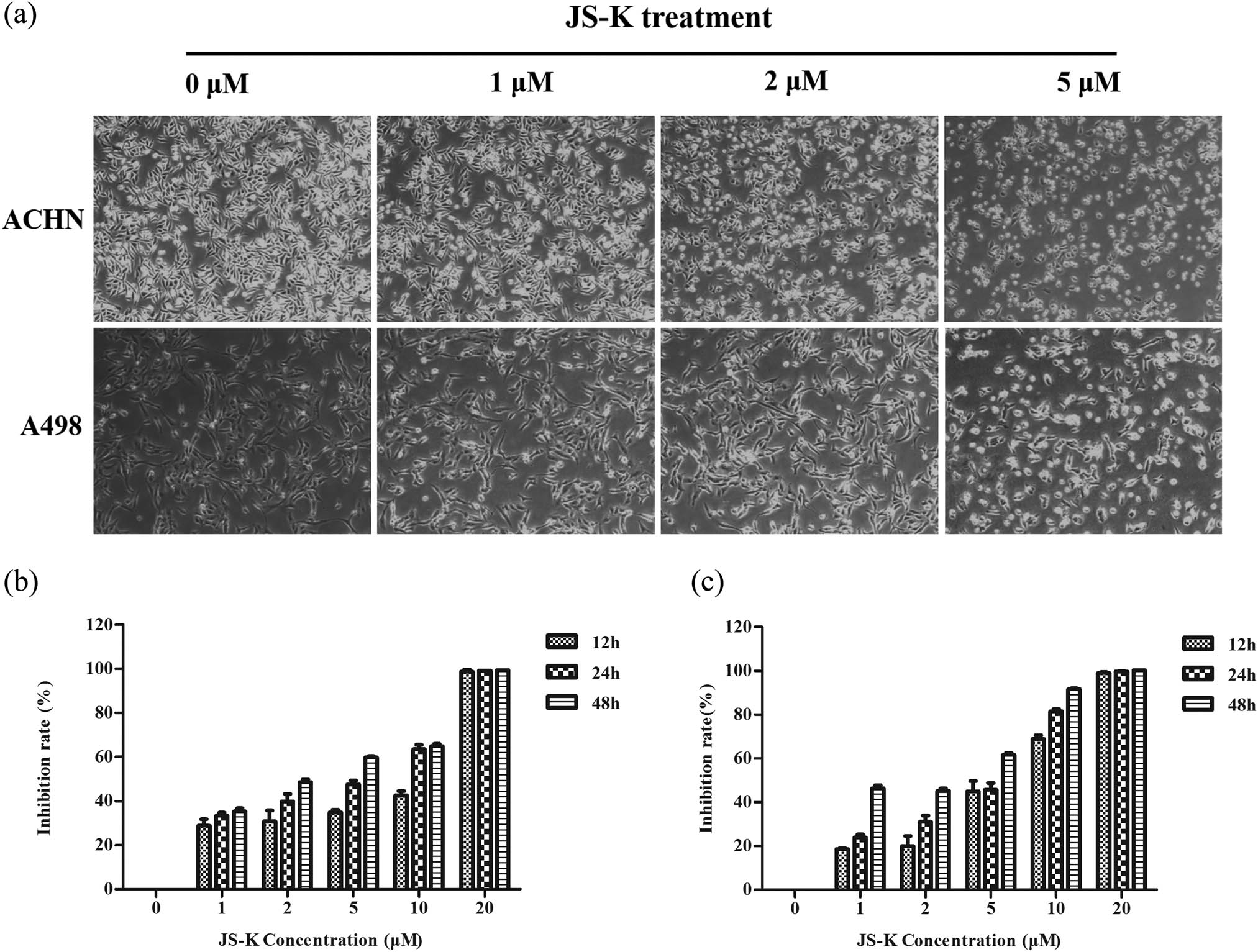 Figure 2
JS-K treatment inhibits renal carcinoma cell proliferation in a dose- and time-dependent manner. (a) Visualized apoptosis caused by microscopy of JS-K in ACHN and A498 cells at 24 h (100×). (b and c) Cells were exposed to various JS-K concentrations (1, 2, 5, 10, and 20 μM) for 12, 24, and 48 h, with an inhibition rate of 0%. Thus, every sample was recreated, and three separate assays (n = 3) are shown in the figure. The findings are presented as mean ± SD.