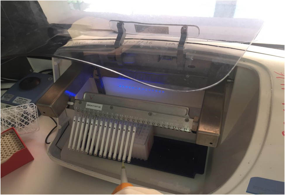 Figure 2
Immunodot image (BlueDiver).