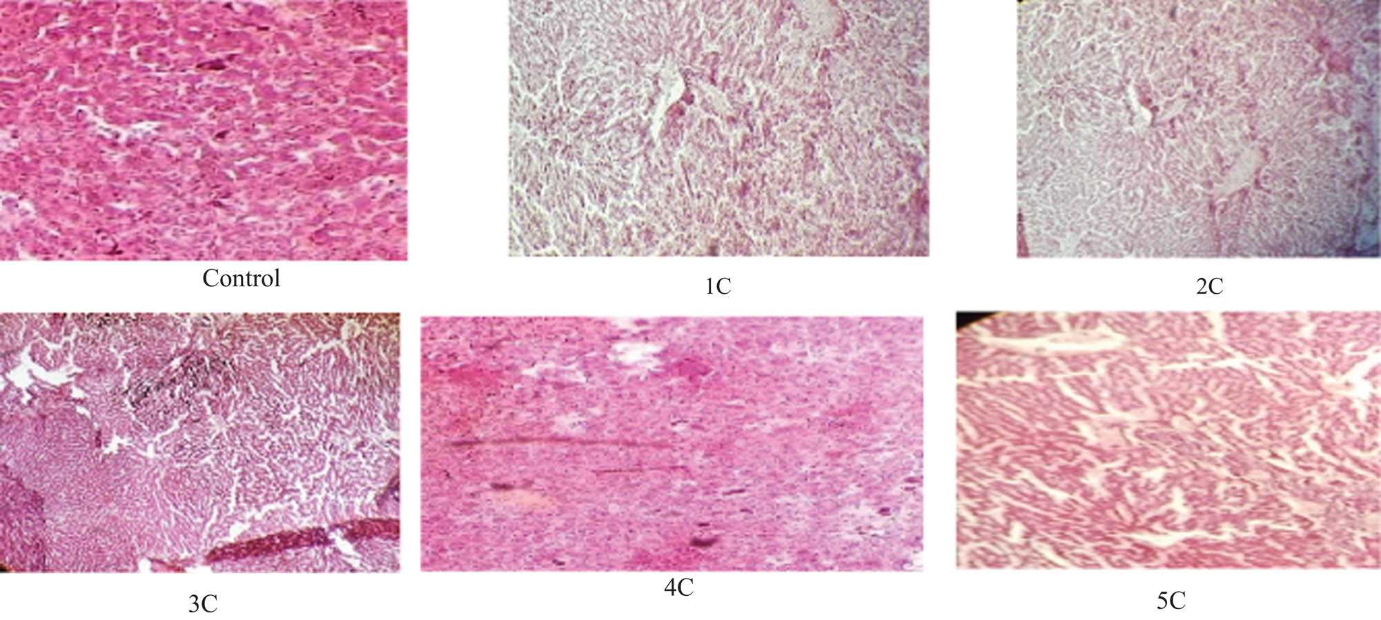Figure 1 Effect of thiourea derivatives on liver (1, 2, 3, 4, and 5 indicate the respective thiourea derivative. C indicates the amount of dose given which is 1.5 mg/kg body weight. Livers were collected at day 30 of the experiment).