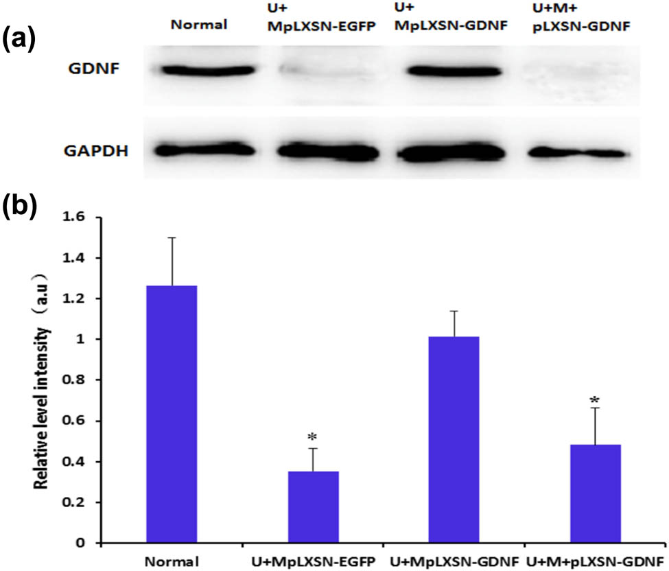 Figure 2 Detection of GDNF protein expression in the substantia nigra of rats from each group by western blot analysis. (a) Expression of GDNF protein in the substantia nigra of rats from each group; (b) relative optical density analysis; compared with the normal group and U + MpLXSN-EGFP group, *P < 0.05.