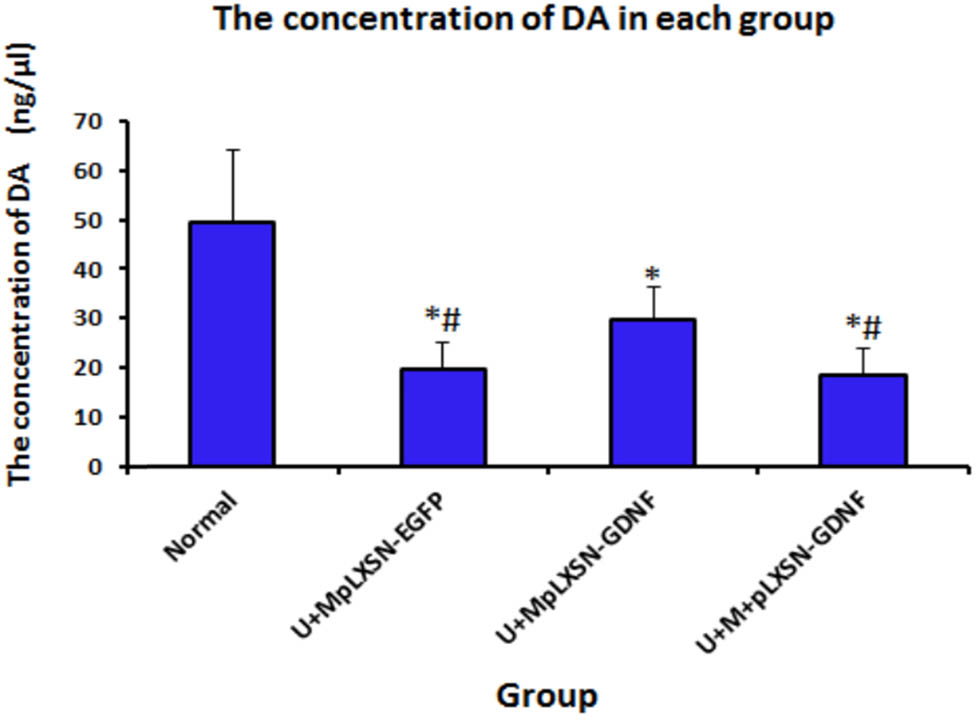 Figure 5 Determination of DA concentration in each group by HPLC. Compared with the normal group **P < 0.01, *P < 0.05, compared with the U + MpLXSN-GDNF group #P < 0.05.