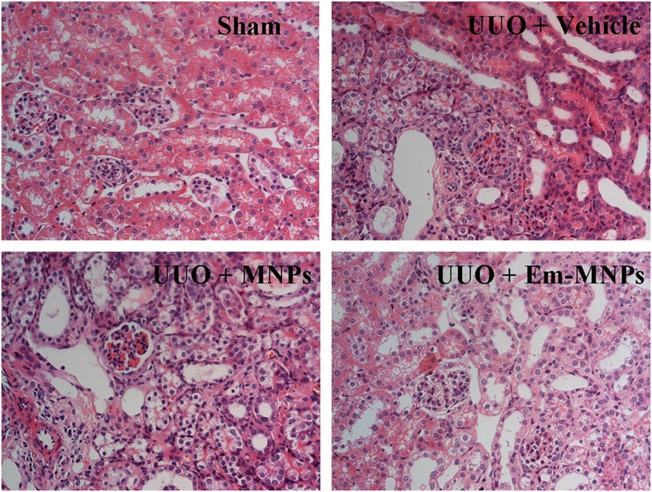 Figure 9 Histology analysis of kidneys. H&E staining images of kidneys from sham-operated, UUO + Vehicle (PBS), UUO + MNPs, and UUO + Em-MNPs mice.