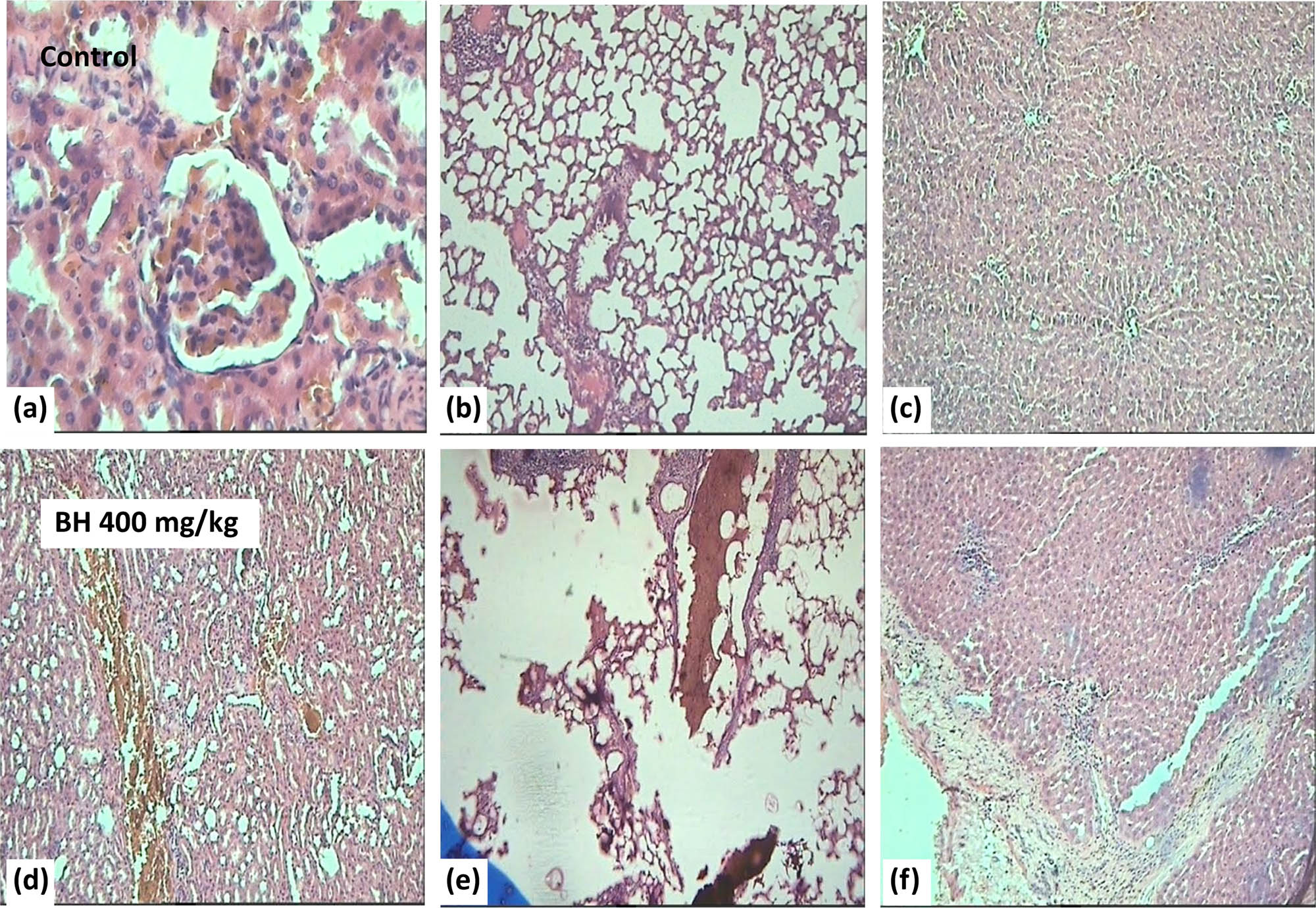 Figure 10
Effect of B. hispanica extracts on the internal organs (kidney, lungs, and liver) of animals treated with 400 mg/kg/day. (a) Sections of kidney parenchyma of untreated rats; (d) sections of kidney parenchyma of treated rats; (b) sections of lung parenchyma of untreated rats; (e) sections of lung parenchyma of treated rats; (c) sections of liver parenchyma of untreated rats; (f) sections of liver parenchyma of treated rats.