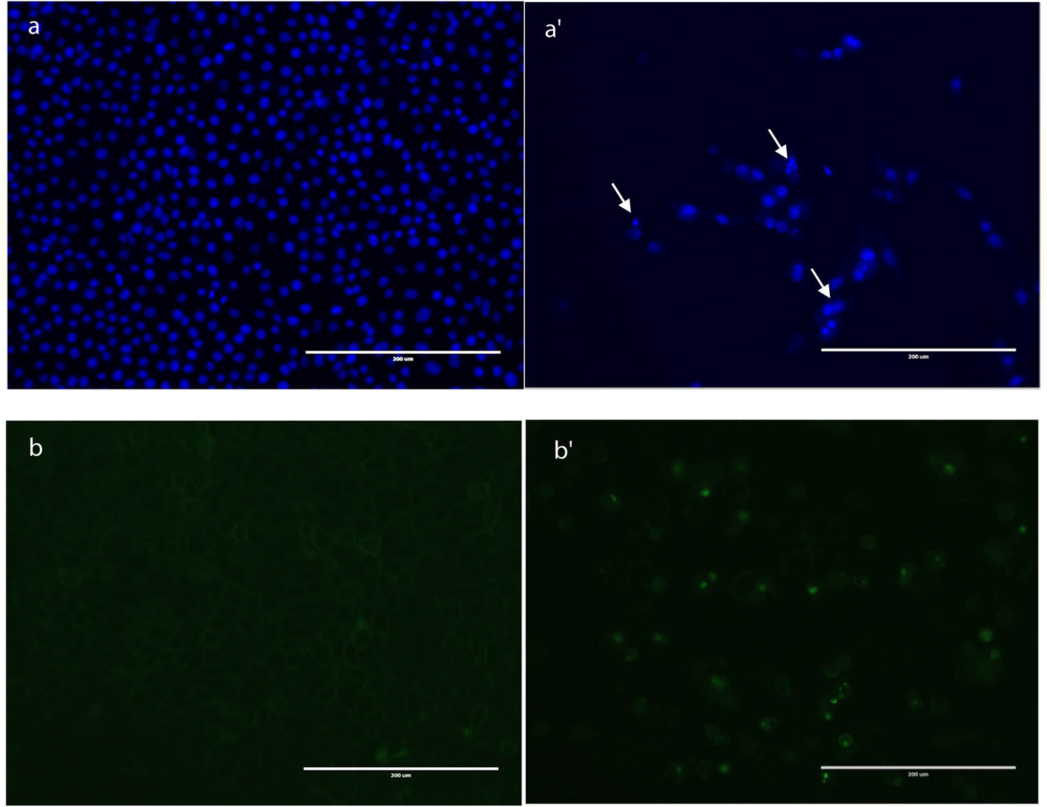 Figure 2
Induction of apoptosis in HepG2 cells by treatment with hexane propolis extract for 48 h. (a) Apoptosis as assessed by nuclear staining. Cells treated with 0.1% methanol vehicle displayed even nuclear staining (a). HepG2 cells showing condensation of DNA (a′). The white arrows show apoptotic cells. (b) control cells, (b′) treated cells.