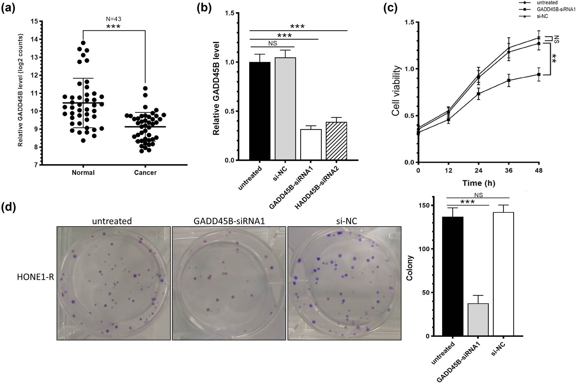 Figure 5
GADD45B effectively improved the activity and proliferation of HONE1-R cells under radiation: (a) TCGA database analysis of GADD45B in squamous cell carcinoma of head and neck; (b) effectiveness and transfection efficiency analysis; (c) cell viability of HONE1-R cell line treated by 6 Gy; and (d) cell proliferation of HONE1-R cell line treated by 6 Gy.