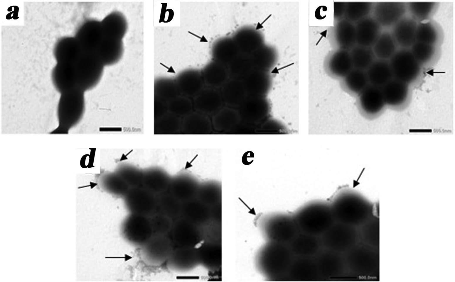Figure 5
TEM images of S. aureus strain in the presence of synthesized phosphates: control S. aureus (a), S. aureus + Na+,
CO
3
2
−
{\text{CO}}_{3}^{2-}
-HAP with particle size in the ranges: 25–50 nm (b) and 300–500 nm (c), S. aureus + Na+, Zn2+,
CO
3
2
−
{\text{CO}}_{3}^{2-}
-HAP (d), S. aureus + Na+, Cu2+,
CO
3
2
−
{\text{CO}}_{3}^{2-}
-HAP (e). Scale is 500 nm.