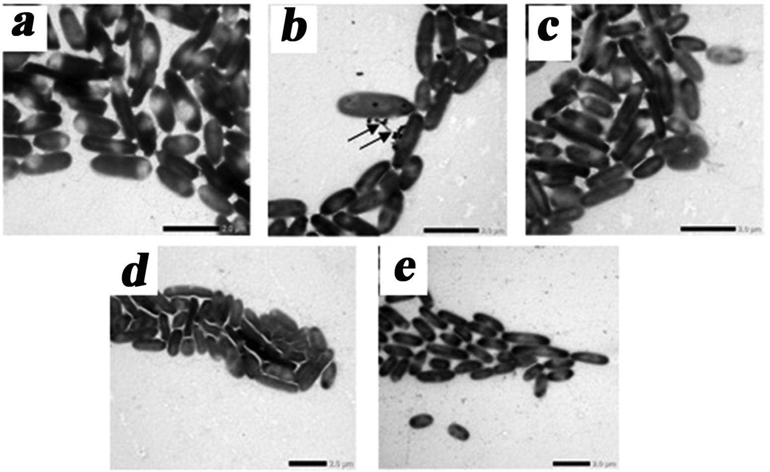 Figure 6
TEM images of P. aeruginosa strain in the presence of synthesized phosphates: control P. aeruginosa (a), P. aeruginosa + Na+,
CO
3
2
−
{\text{CO}}_{3}^{2-}
-HAP with size of particles in the ranges: 25–50 nm (b) and 300–500 nm (c), P. aeruginosa + Na+, Zn2+,
CO
3
2
−
{\text{CO}}_{3}^{2-}
-HAP (d), P. aeruginosa + Na+, Cu2+,
CO
3
2
−
{\text{CO}}_{3}^{2-}
-HAP (e). Scale is 2.0 μm.