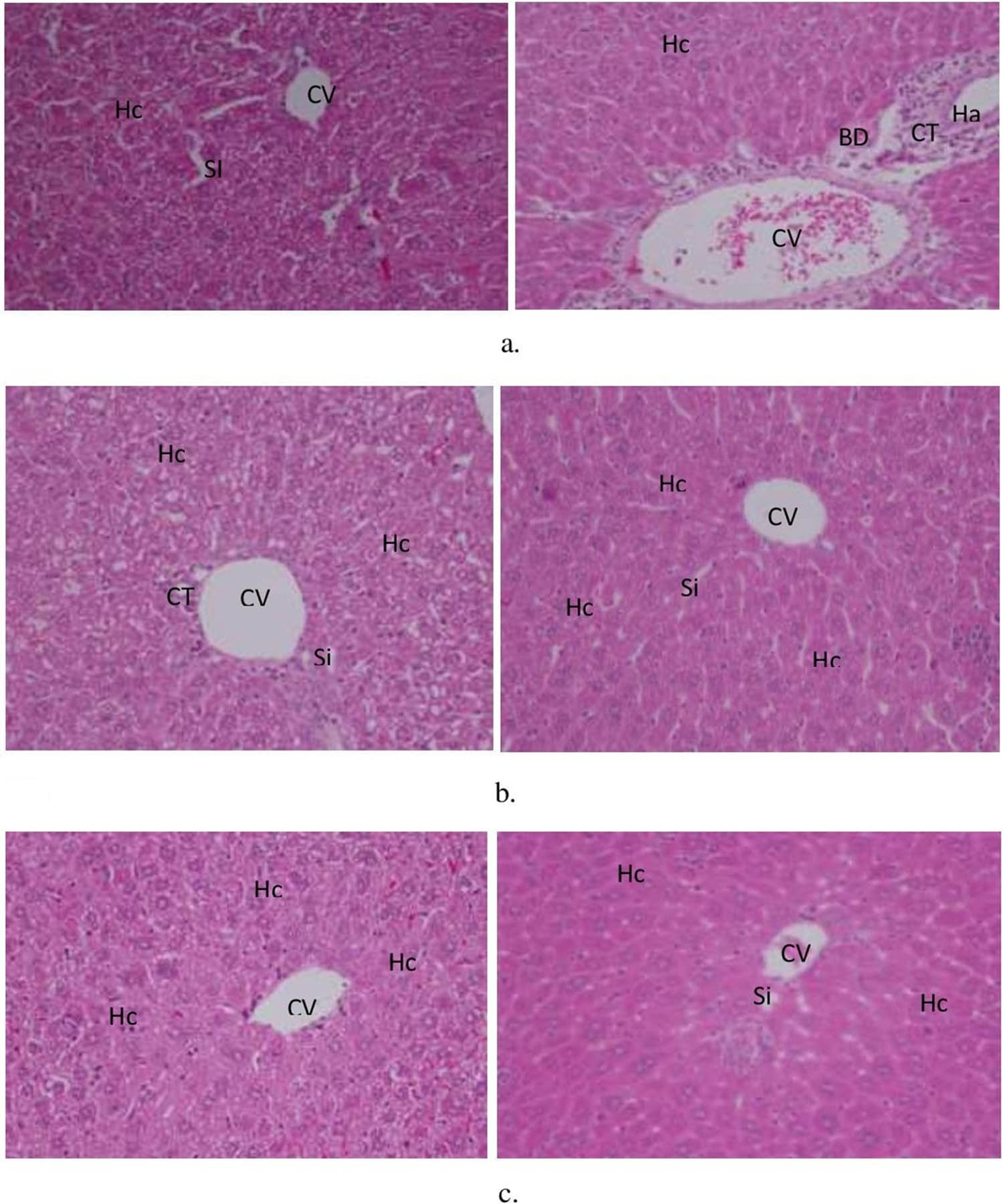 Figure 3 
                  (a–c) Photomicrograph of liver sections of male and female mice treated with RVWSE before mating (group I), and during pregnancy (group II) (×100 or ×200 magnification). [CV = central vein, BD = bile duct, Hc = hepatocytes, CT = connective tissue. Si = sinusoid, Ha = Hepatic artery]. (a) Group I female liver control (×100) and Group I female liver treated (×200). (b) Group II female liver control (×100) and Group II female liver treated liver (×100). (c) Male liver control (×100) and male liver treated (×100).
               