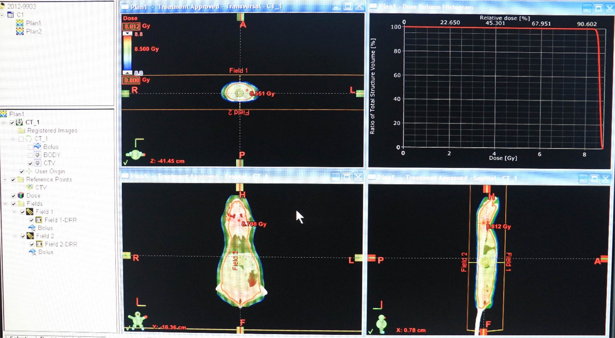 Figure 3
Planning procedure along with the given doses and treatment details.