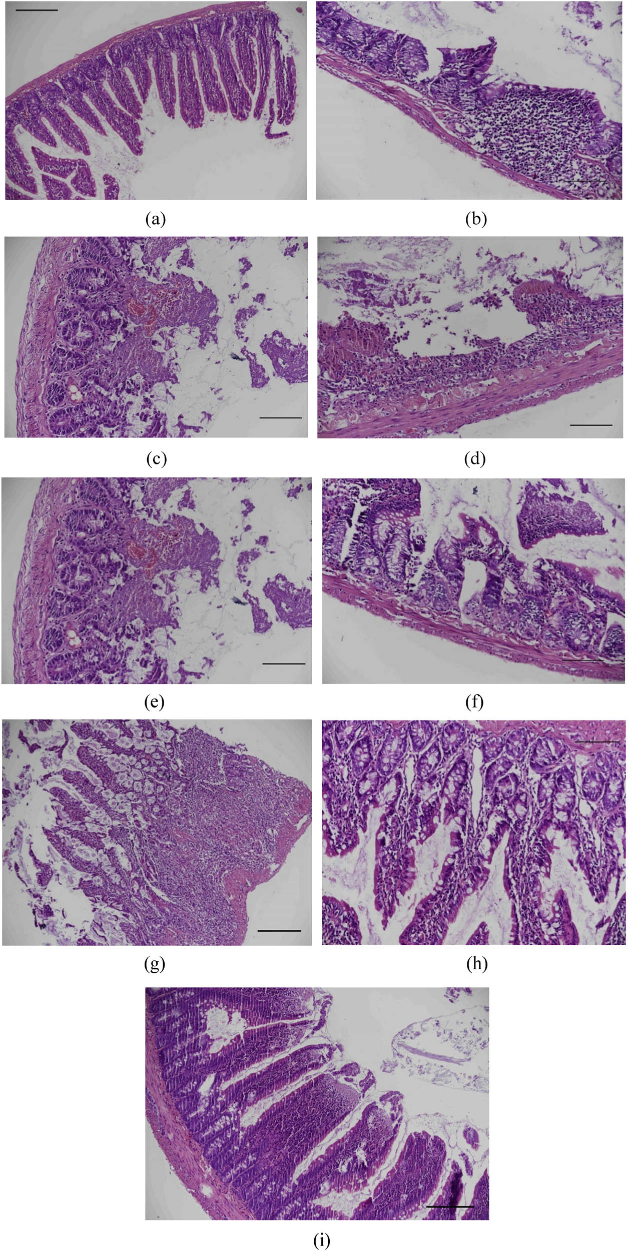 Figure 6
Photomicrographs of ileal sections stained with HE. (a) The ileum samples from the control group showed regular morphology and revealed minimum Chiu score of 0. (b and c) The ileum samples from the AM-treated rats showed slight thickening and irregularity in some villi, light epithelial lift in the apical regions of some villi, minimal degenerative changes in the epithelial cells, generally normal scattered goblet cells, and revealed Chiu score of 1 and 2. (d–f) The ileum samples from the IR group showed thickened and irregular villi, heavy degenerative changes in the epithelial cells, breakage in the epithelial cells, decrease in the goblet cells and mucins, capillary congestion in the villus, denudation of the Lieberkühn crypts, intense inflammatory cells, ulceration, and revealed maximum Chiu score of 5. (g–i) The ileum samples from the AM + IR group showed thickened and irregular villi, lifting of epithelial layer from the lamina propria, increase in the goblet cells and mucins, and revealed Chiu score of 3; (a, c, g, and i: Scale bars: 200 μm, b, d, e, f, and h: Scale bars: 100 μm).