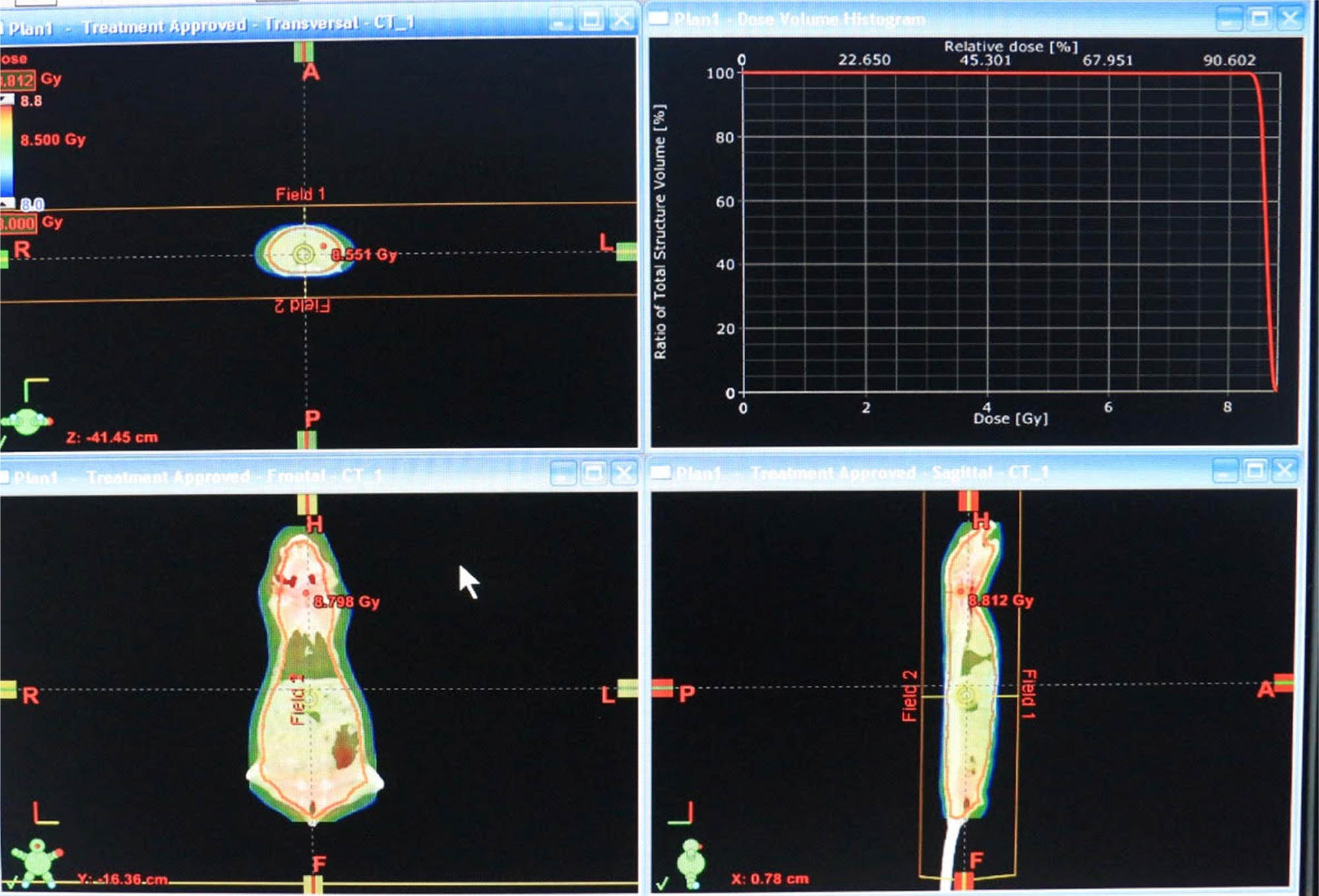 Figure 3 
                  Planning procedure along with the given doses and treatment details.
               