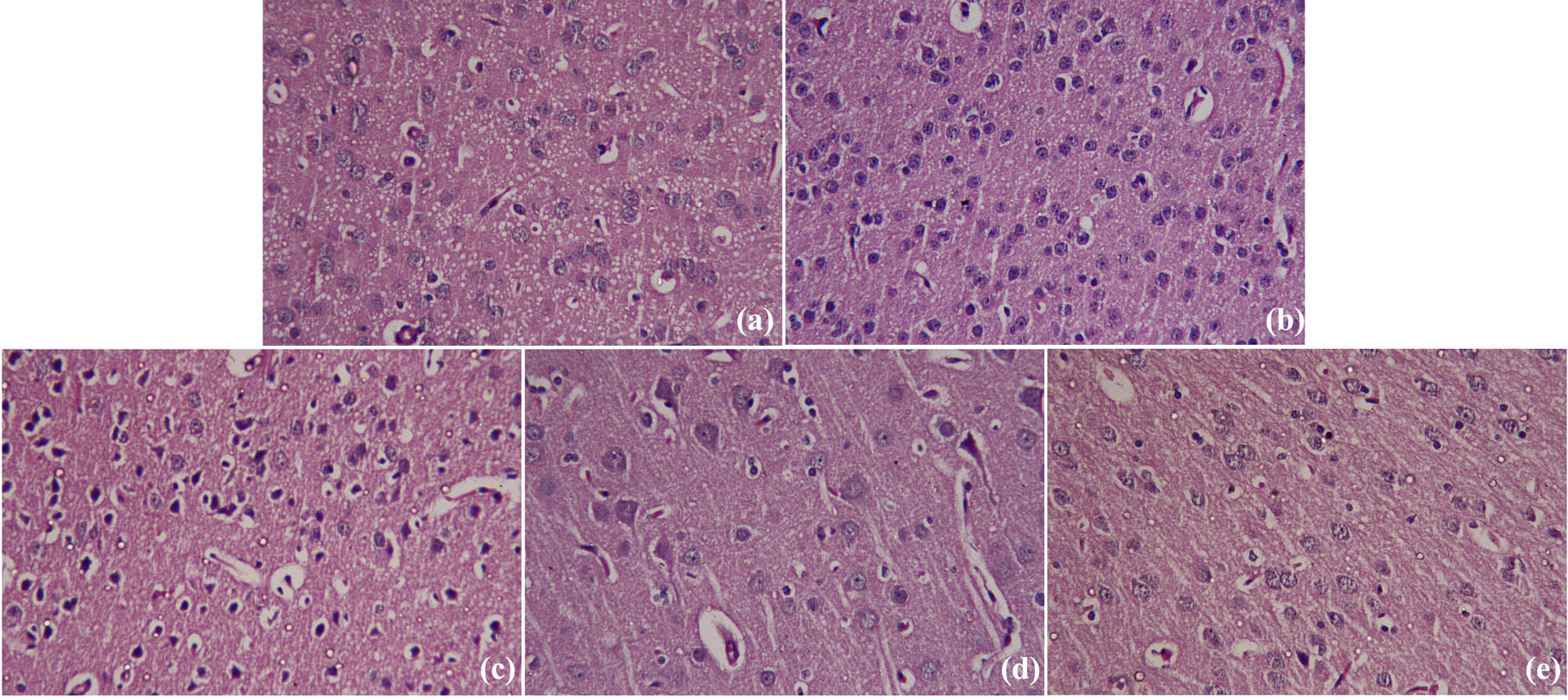 Figure 9
Histopathological examination of cortical tissue in brain of mice intoxicated with AlCl3 and treated with AaE or SeNPs-AaE. The control (a) and AaE (b) groups showed normal brain cell morphology, whereas the AlCl3 (c) group displayed neuronal degeneration and histological alterations. Meanwhile, treating these AlCl3-exposed rats with AaE (d) or SeNPs-AaE (e) resulted in near-normal morphology. Magnification = 400×.
