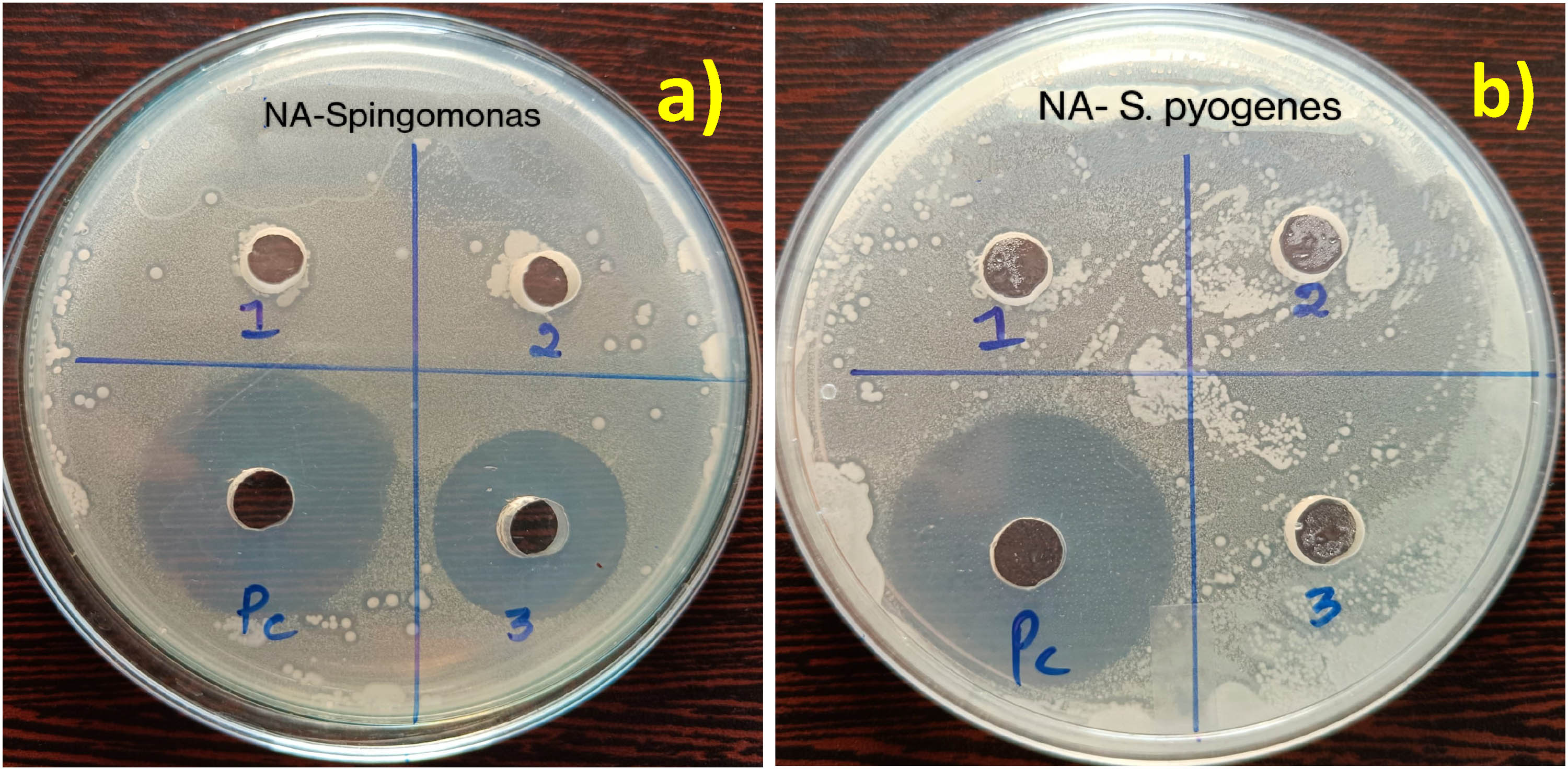 Figure 11 
                     Antibacterial properties of Co/ZnO against (a) S. pausimobilis and (b) S. pyrogenes.
                     
                  