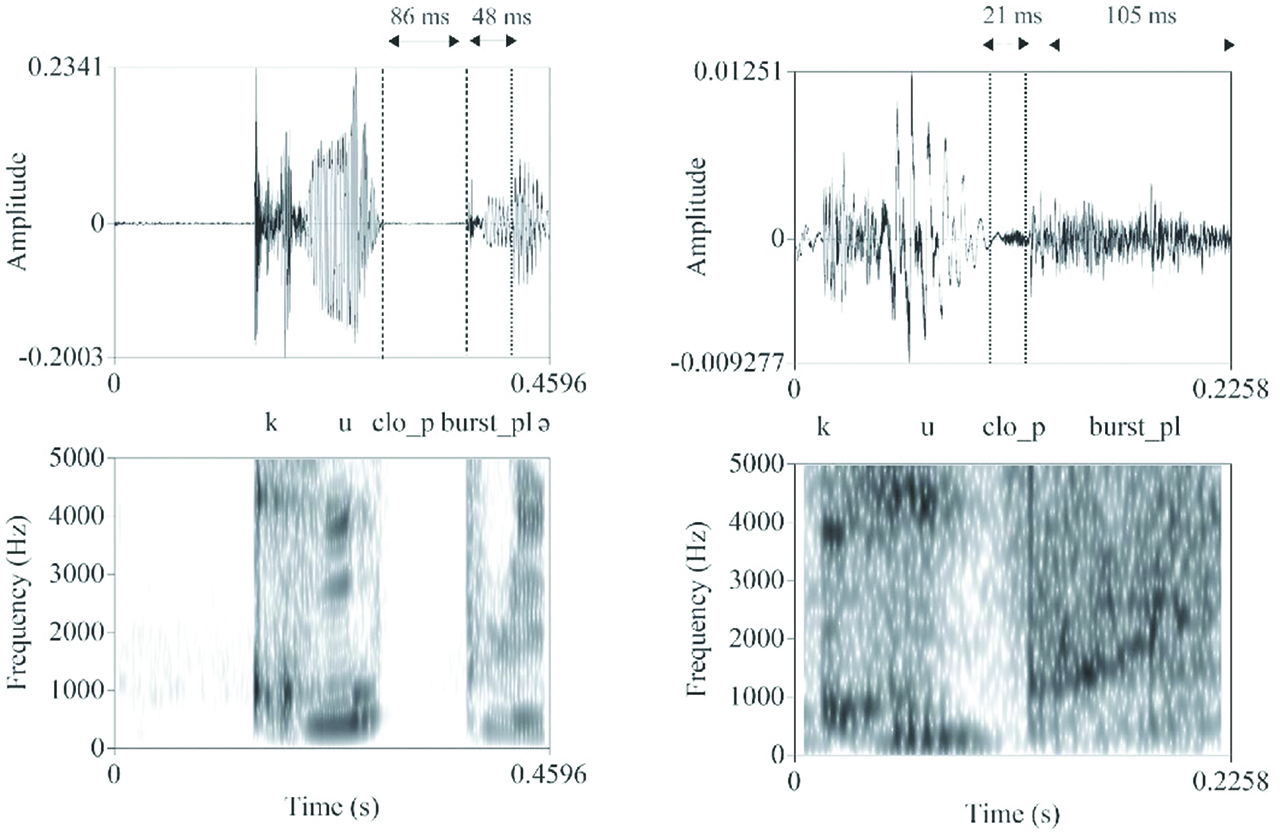 Figure 3: 
Two pronunciation variants of couple /kuplə/ ‘couple’. In the variant on the right, which is followed by pour, the burst of the stop and the liquid together (burst_pl) are unexpectedly long compared to the duration of the stop’s closure (clo_p) and to the duration of the preceding vowel. This is not the case in the variant on the left, which is followed by depuis.

