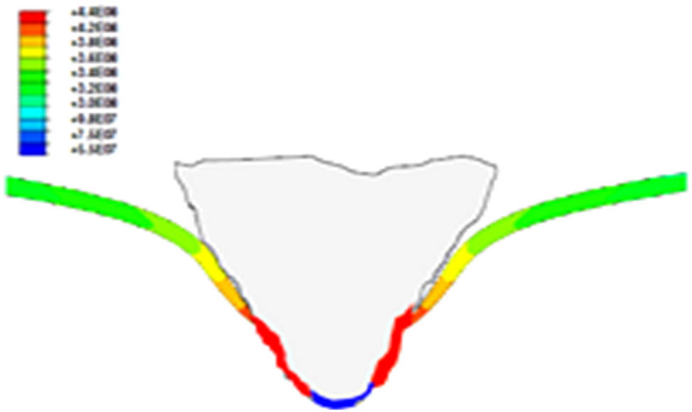 Figure 15 
                  Finite element analysis that highlights maximum tension recorded on the basis of von Mises criterion involves maximum deformation of the composite [153].
               
